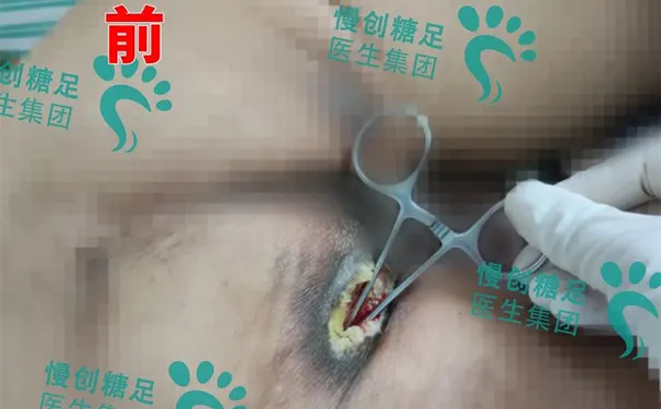 杭州博养压疮治疗中心 杭州博养压疮治疗中心