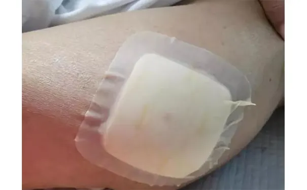 杭州博养压疮治疗中心 杭州博养压疮治疗中心