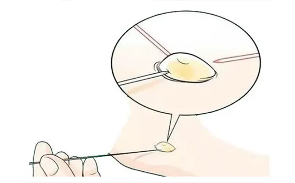 杭州博养压疮治疗中心 杭州博养压疮治疗中心