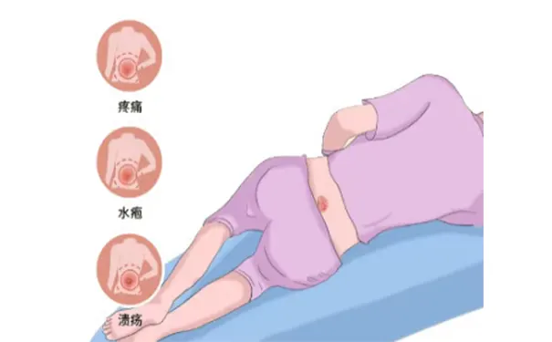 杭州博养压疮治疗中心 杭州博养压疮治疗中心