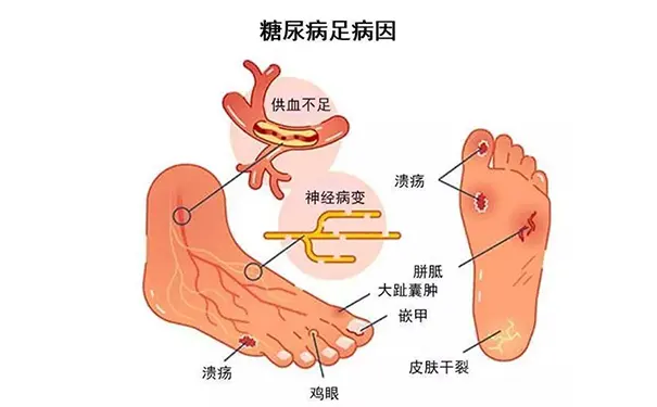 杭州博养压疮治疗中心 杭州博养压疮治疗中心