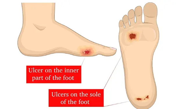 杭州博养压疮治疗中心 杭州博养压疮治疗中心