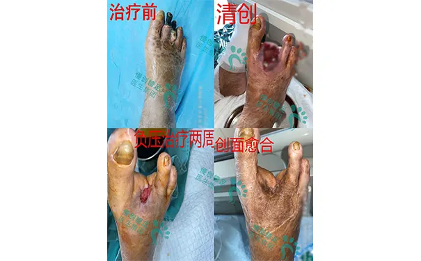 杭州博养压疮治疗中心 杭州博养压疮治疗中心