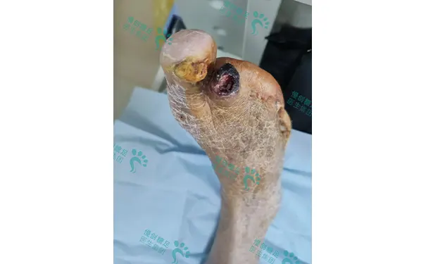 杭州博养压疮治疗中心 杭州博养压疮治疗中心