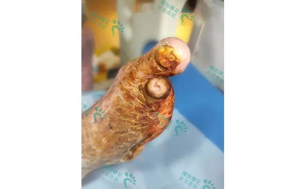 杭州博养压疮治疗中心 杭州博养压疮治疗中心