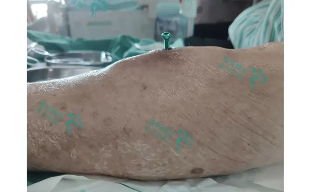 杭州博养压疮治疗中心 杭州博养压疮治疗中心