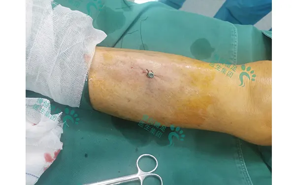 杭州博养压疮治疗中心 杭州博养压疮治疗中心