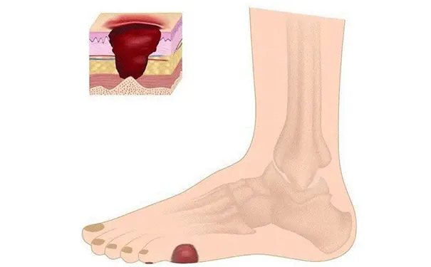 杭州博养压疮治疗中心 杭州博养压疮治疗中心