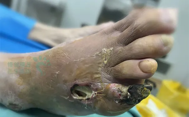 杭州博养压疮治疗中心 杭州博养压疮治疗中心