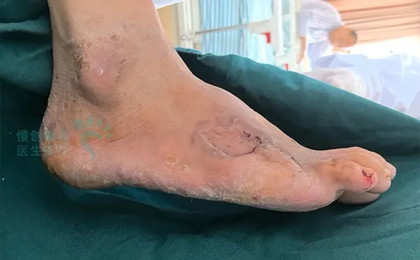 杭州博养压疮治疗中心 杭州博养压疮治疗中心