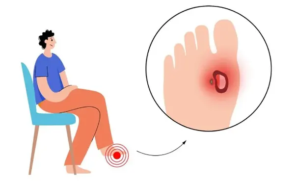 杭州博养压疮治疗中心 杭州博养压疮治疗中心