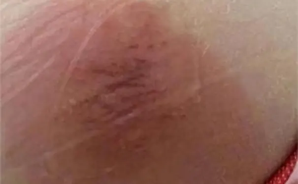 杭州博养压疮治疗中心 杭州博养压疮治疗中心