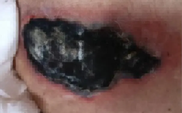 杭州博养压疮治疗中心 杭州博养压疮治疗中心