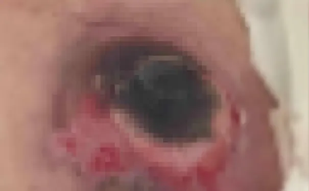 杭州博养压疮治疗中心 杭州博养压疮治疗中心