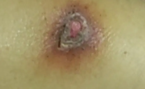 杭州博养压疮治疗中心 杭州博养压疮治疗中心