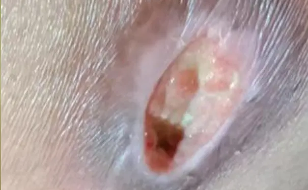 杭州博养压疮治疗中心 杭州博养压疮治疗中心