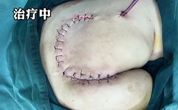 杭州博养压疮治疗中心 杭州博养压疮治疗中心