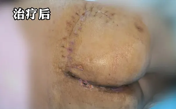 杭州博养压疮治疗中心 杭州博养压疮治疗中心