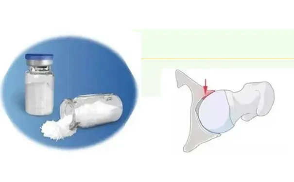 杭州博养压疮治疗中心 杭州博养压疮治疗中心