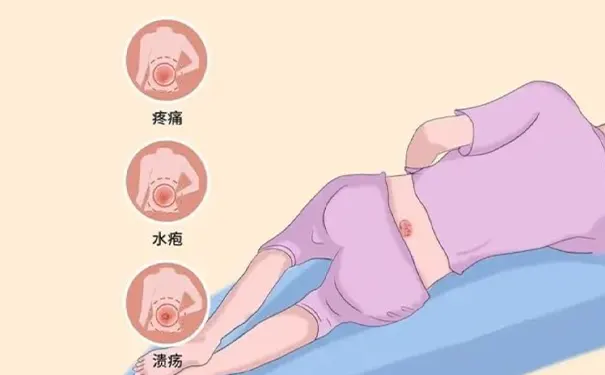 杭州博养压疮治疗中心 杭州博养压疮治疗中心