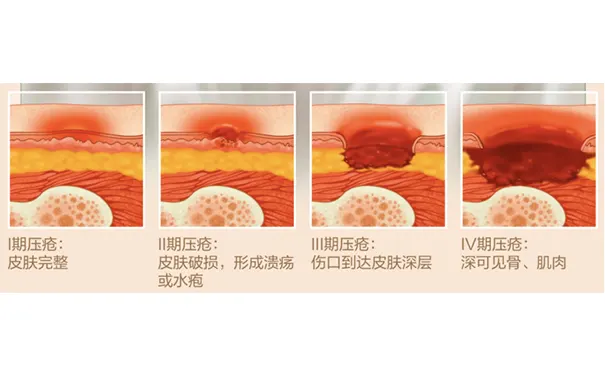 杭州博养压疮治疗中心 杭州博养压疮治疗中心