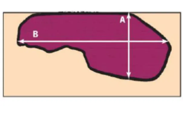 杭州博养压疮治疗中心 杭州博养压疮治疗中心