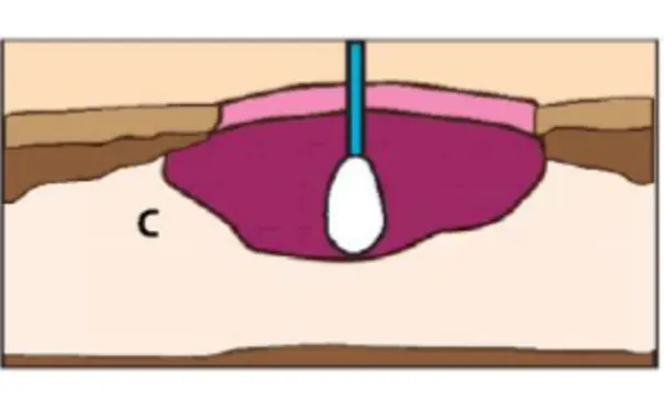 杭州博养压疮治疗中心 杭州博养压疮治疗中心