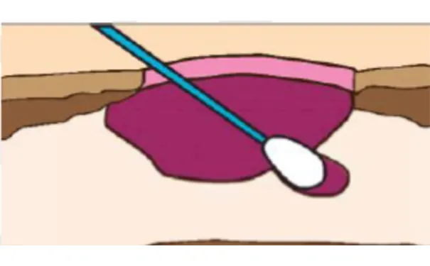 杭州博养压疮治疗中心 杭州博养压疮治疗中心