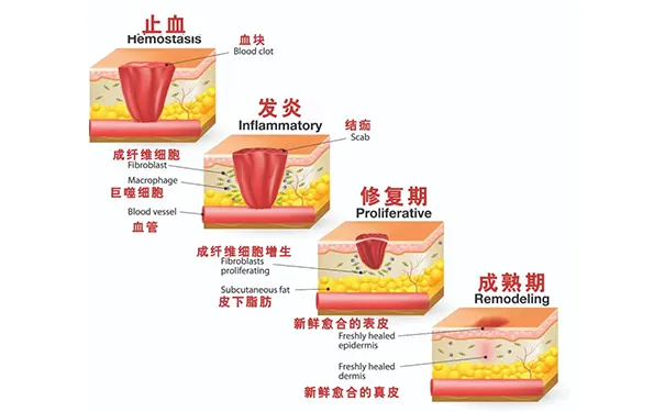 杭州博养压疮治疗中心 杭州博养压疮治疗中心