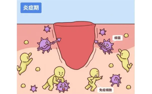 杭州博养压疮治疗中心 杭州博养压疮治疗中心