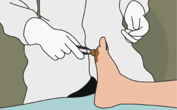 杭州博养压疮治疗中心 杭州博养压疮治疗中心