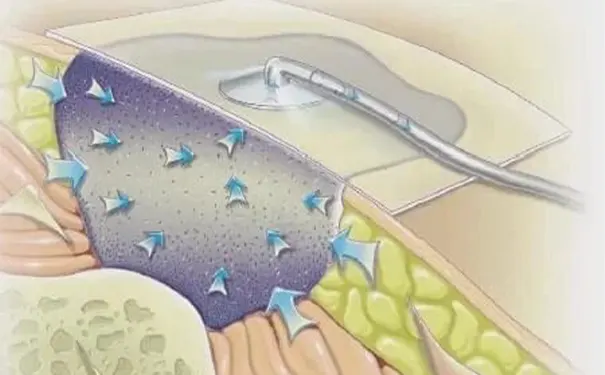 杭州博养压疮治疗中心 杭州博养压疮治疗中心