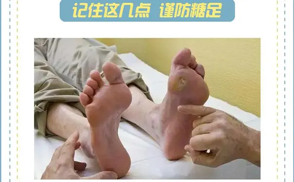 杭州博养压疮治疗中心 杭州博养压疮治疗中心