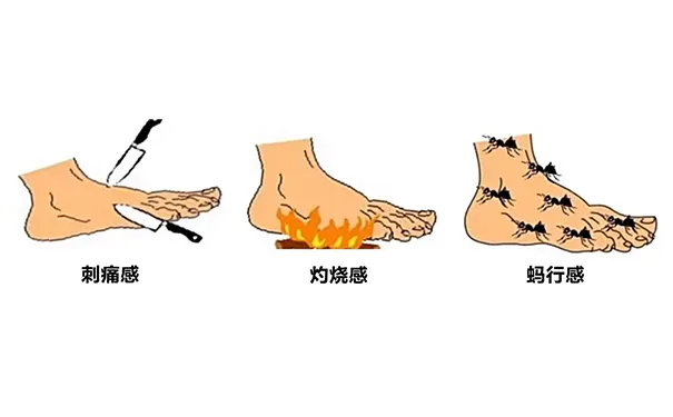 杭州博养压疮治疗中心 杭州博养压疮治疗中心