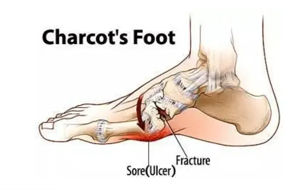 杭州博养压疮治疗中心 杭州博养压疮治疗中心