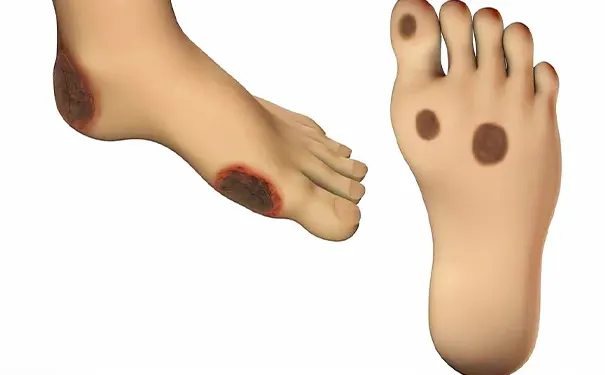 杭州博养压疮治疗中心 杭州博养压疮治疗中心