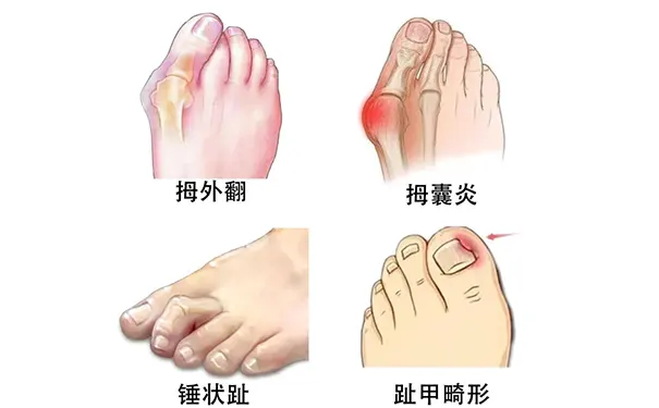 杭州博养压疮治疗中心 杭州博养压疮治疗中心