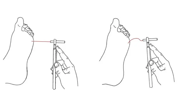 杭州博养压疮治疗中心 杭州博养压疮治疗中心