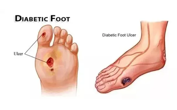 杭州博养压疮治疗中心 杭州博养压疮治疗中心