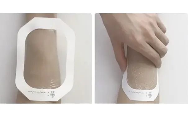 杭州博养压疮治疗中心 杭州博养压疮治疗中心