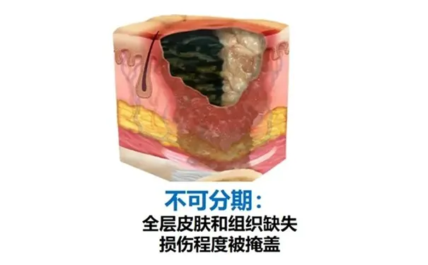 杭州博养压疮治疗中心 杭州博养压疮治疗中心