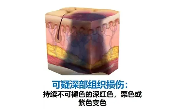 杭州博养压疮治疗中心 杭州博养压疮治疗中心