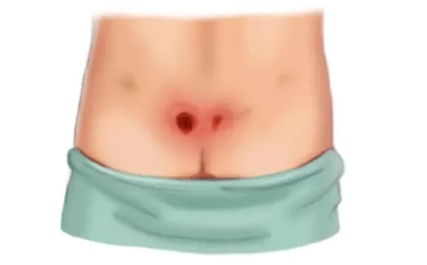 杭州博养压疮治疗中心 杭州博养压疮治疗中心