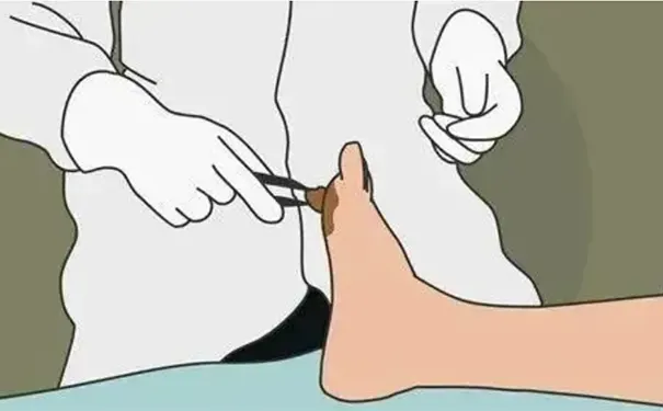 杭州博养压疮治疗中心 杭州博养压疮治疗中心