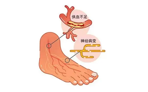 杭州博养压疮治疗中心 杭州博养压疮治疗中心