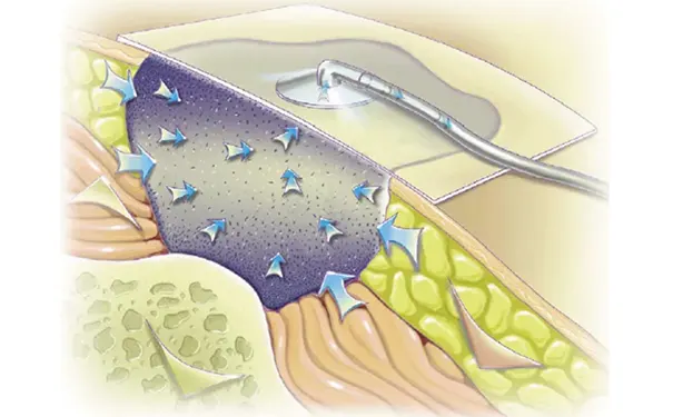 杭州博养压疮治疗中心 杭州博养压疮治疗中心