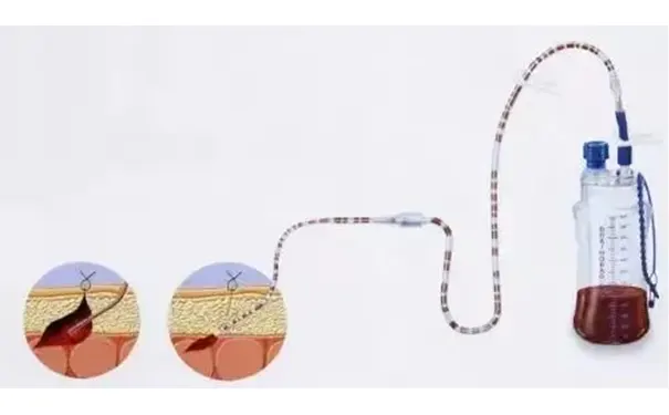 杭州博养压疮治疗中心 杭州博养压疮治疗中心