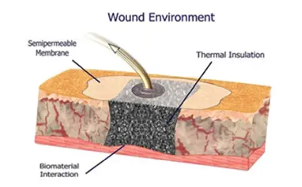 杭州博养压疮治疗中心 杭州博养压疮治疗中心