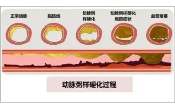 杭州博养压疮治疗中心 杭州博养压疮治疗中心