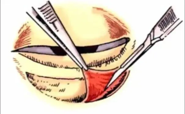 杭州博养压疮治疗中心 杭州博养压疮治疗中心